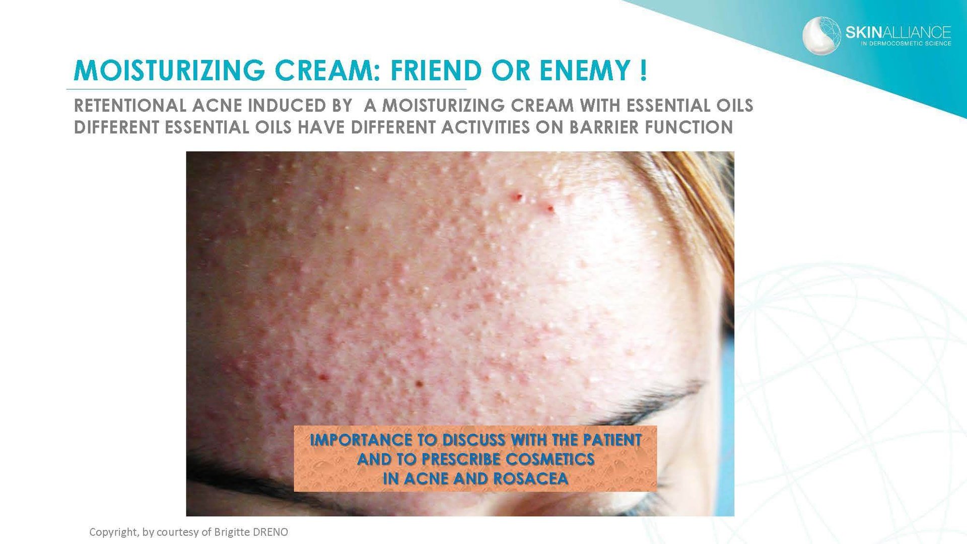 Dermocosmetics in Skin Acne and Rosacea Friend or Enemy_Page_22