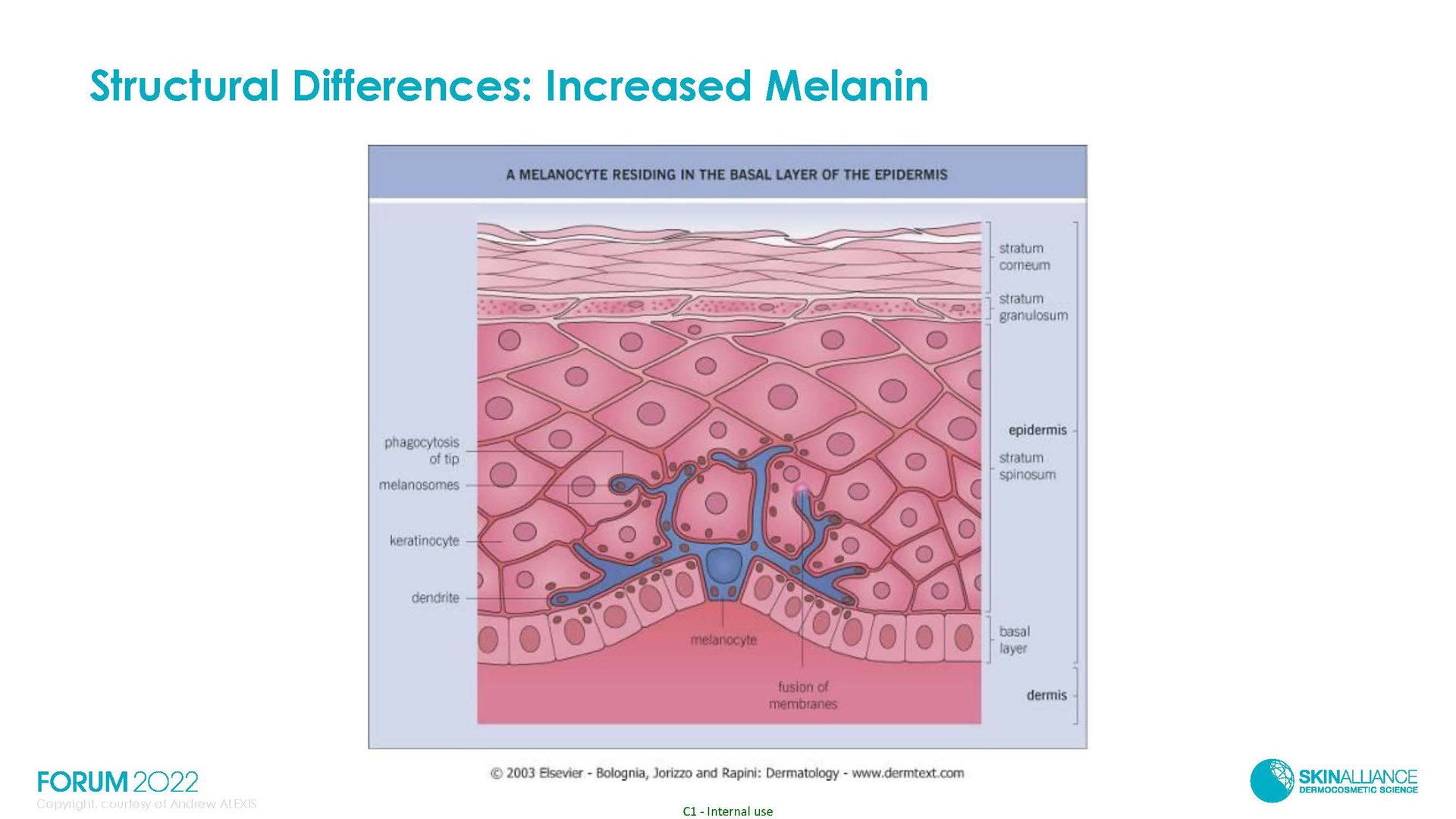 Hyperpigmentation in Ethnic Skin
