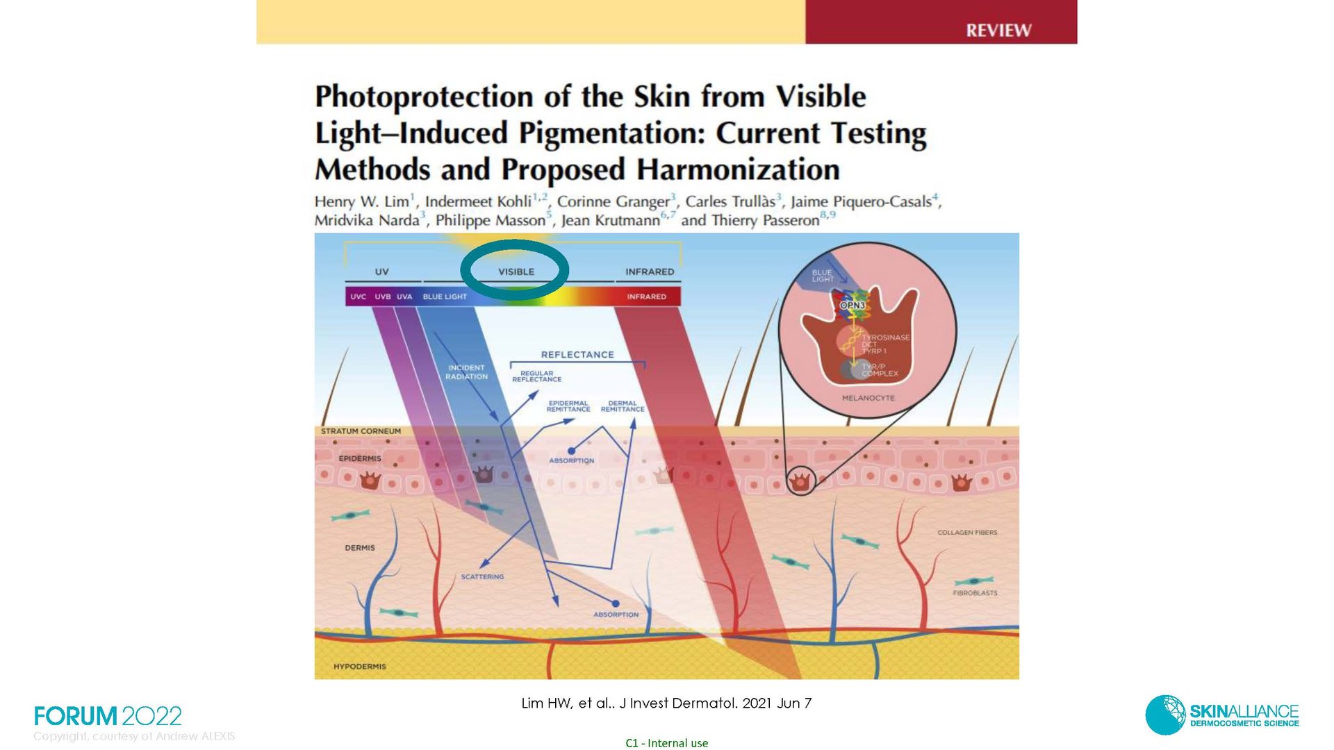 Hyperpigmentation  in Ethnic Skin