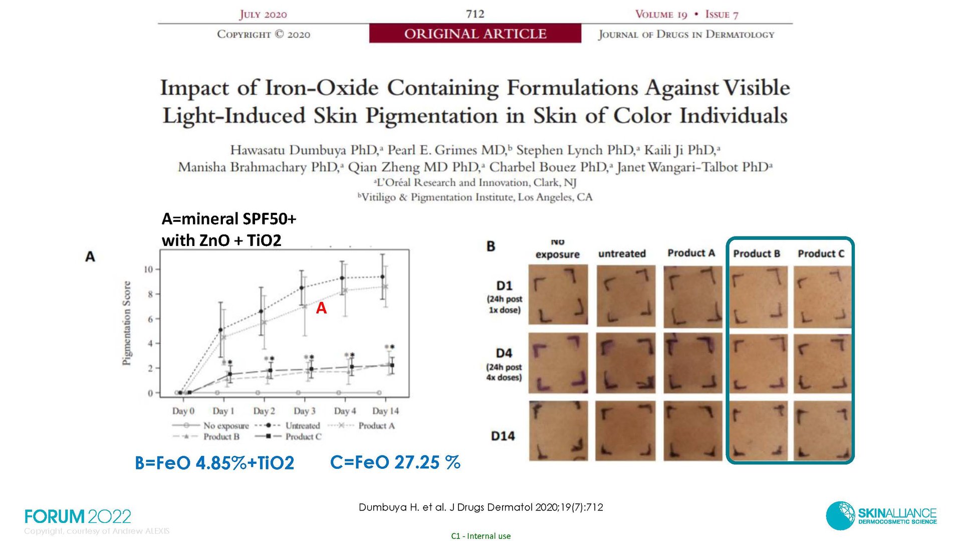 Hyperpigmentation in Ethnic Skin