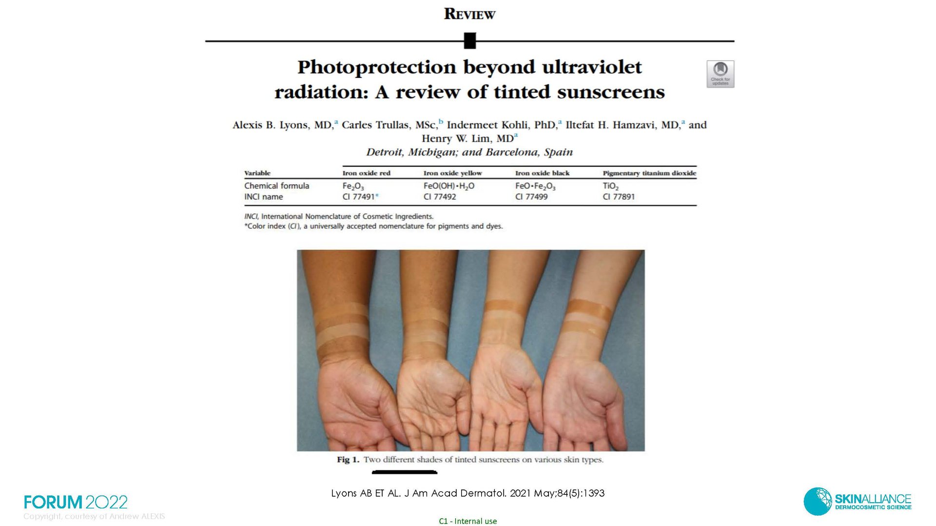 Hyperpigmentation in Ethnic Skin
