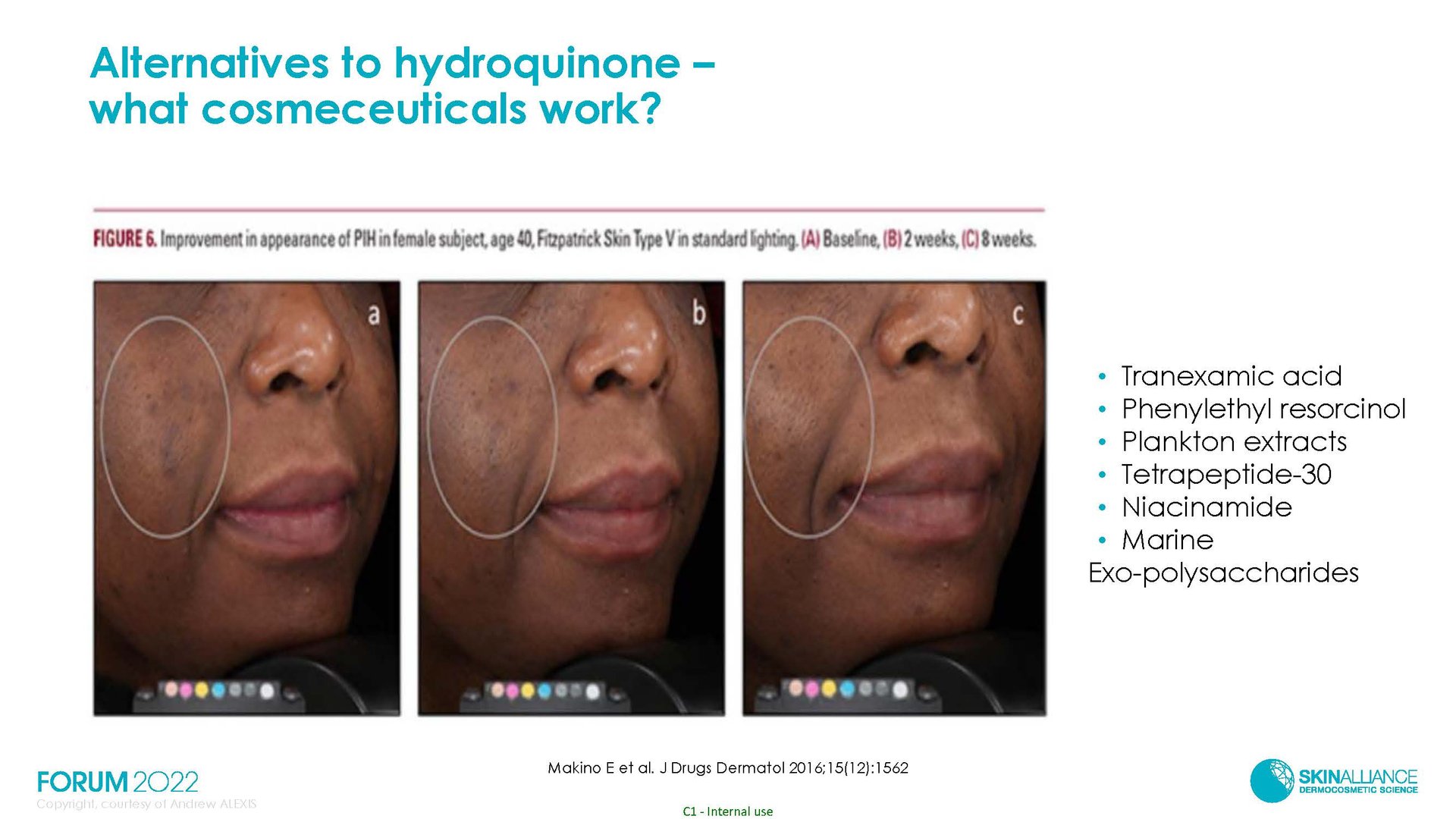 Hyperpigmentation in Ethnic Skin